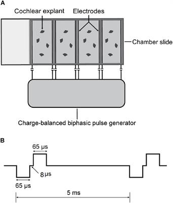 Electrical Stimulation Degenerated Cochlear Synapses Through Oxidative Stress in Neonatal Cochlear Explants